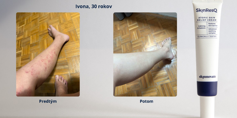 Ivona, 30r